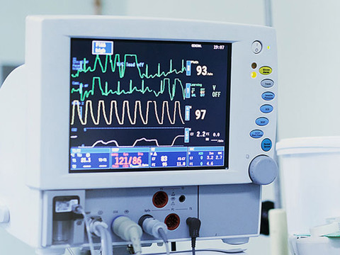Wykrywanie zaburzeń rytmu serca w EKG