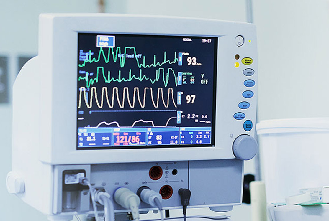 Wykrywanie zaburzeń rytmu serca w EKG
