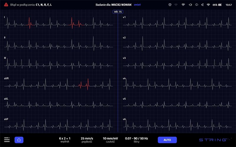 string siatka black 2